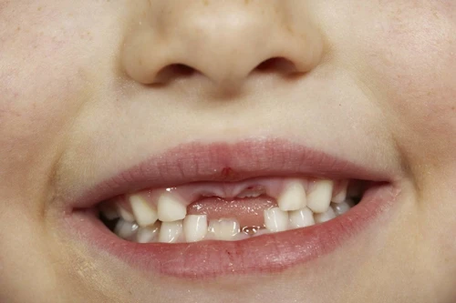 Tannheilsa