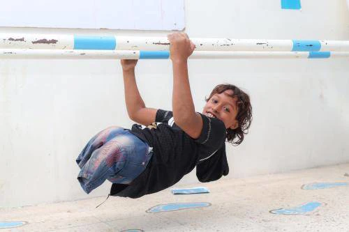 Emad, 11 ára, á stoðtækjamiðstöðinni í Aden í Jemen. Emad missti báða fætur í sprengingu á heimilinu sínu. Eldri bróðir hans slasaðist líka. Emad fékk hjálp strax eftir sprenginguna og var síðan fluttur á stoðtækjamiðstöðina þar sem hann fær gervifætur og þjálfun. Ljósmynd: UNICEF